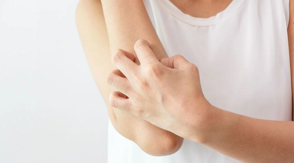 Todo sobre los eccemas en la piel